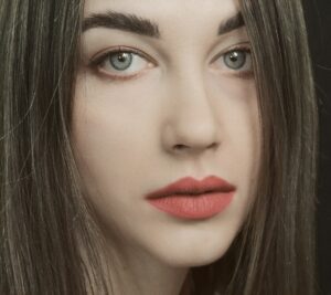 Botox Den Haag